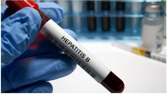 Dinkes DKI Jakarta Ungkap ada 24 Kasus yang Dicurigai Sebagai Hepatitis Misterius