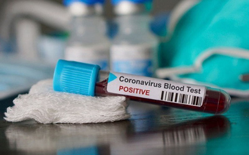 Kasus Harian Meningkat, Enovid Manjur Basmi Virus di Rongga HidungĀ